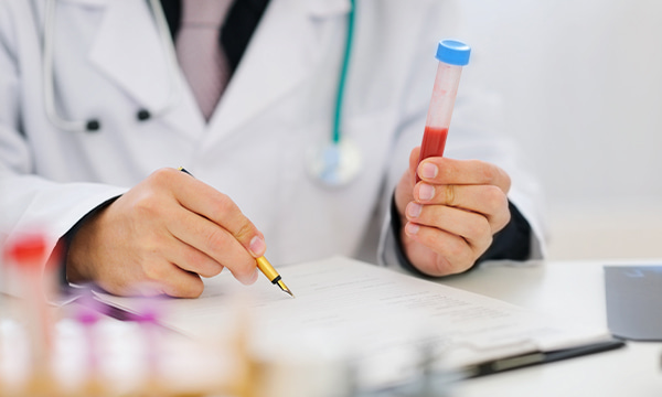 Исследование уровня бета-2-микроглобулина в моче