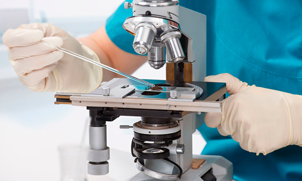 Анализ соскоба с кожи на клещей (Демодекс)