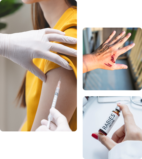 Осложнения после прививки от бешенства