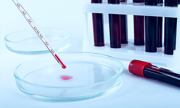 Исследование времени кровотечения (по Дуке)