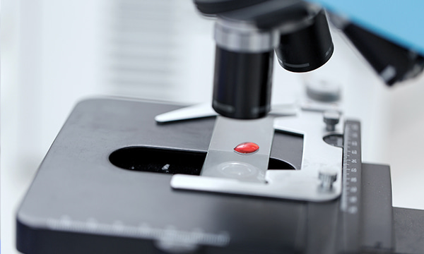 Анализ крови на медь