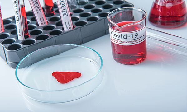 Ускоренный ПЦР-тест на COVID-19 (до 1 дня)