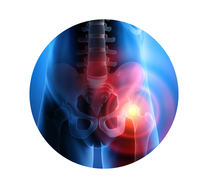 Рентген тазобедренного сустава