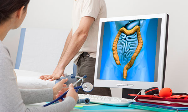 Иссечение полипа анального канала