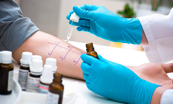 Антитела IgE к аллергену Берёзы, t3 (ImmunoCAP) Антитела IgE к аллергену Берёзы, t3 (ImmunoCAP)