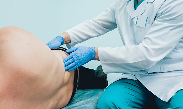 Удаление полипа уретры