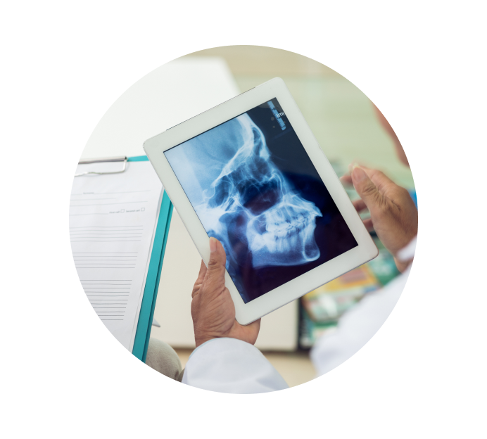 Рентген височно-нижнечелюстного сустава