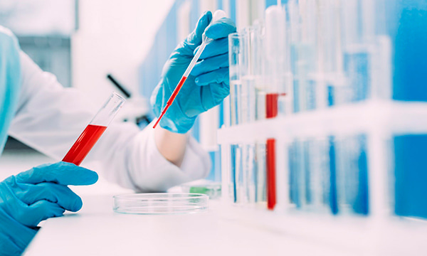 Коагулограмма (ПТИ+МНО+АЧТВ+ТВ+фибриноген)