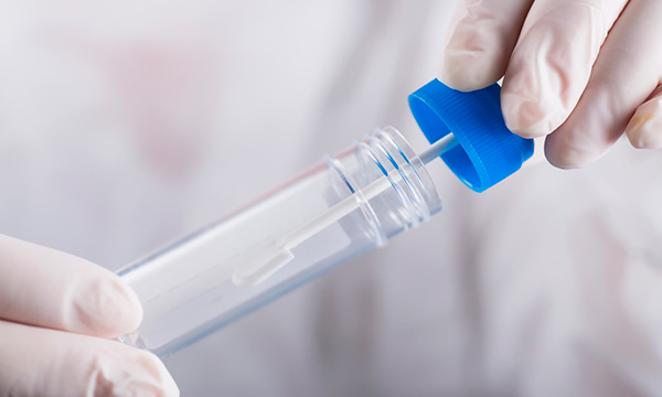 Анализ кала на углеводы