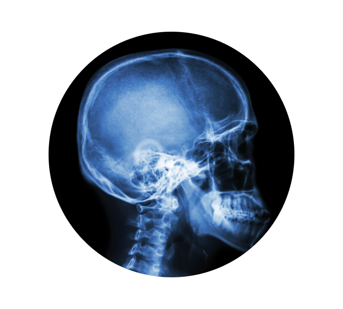 Рентген турецкого седла