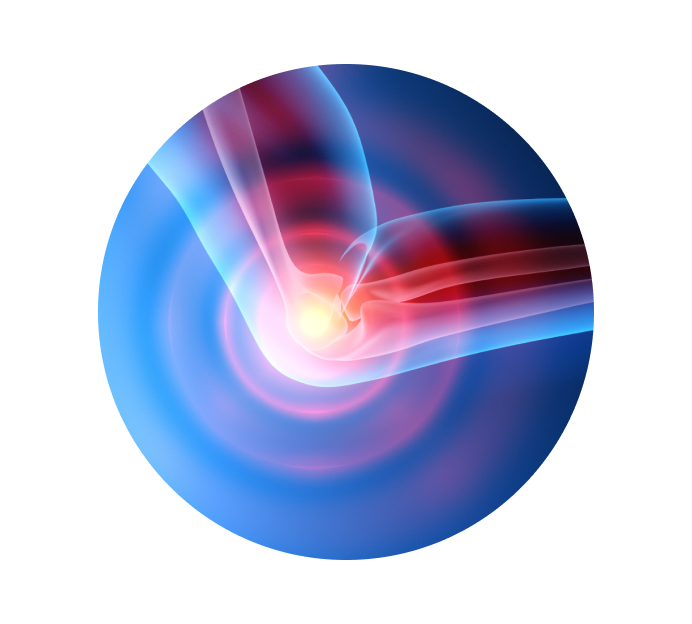 Рентген локтевого сустава