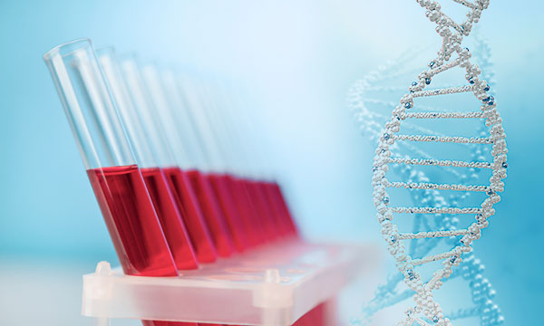 Анализ крови на антитела к токсоплазме