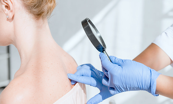 Дерматоскопия