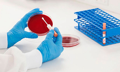 Микробиологическое (культуральное) исследование крови на стерильность с определением чувствительности к антимикотическим и антимикробным химиотерапевтическим препаратам
