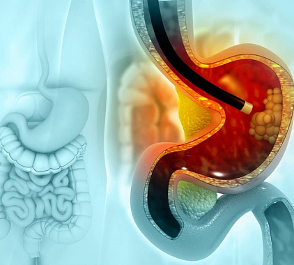 Эндоскопия