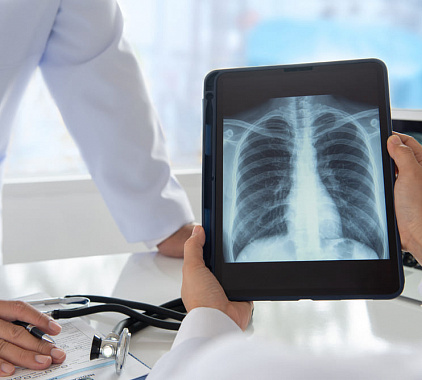 Рентгенография