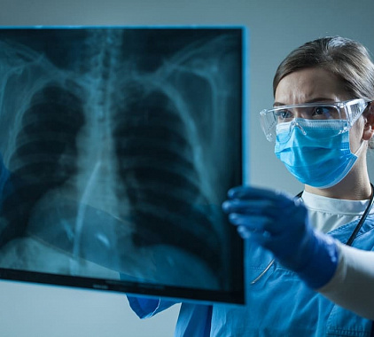 Рентгенография