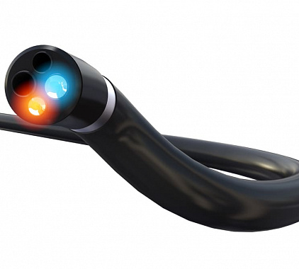 Эндоскопия