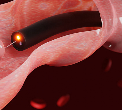 Эндоскопия